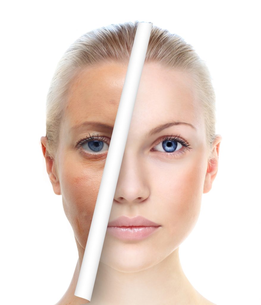 Natural Skin Hyperpigmentation Remedies
